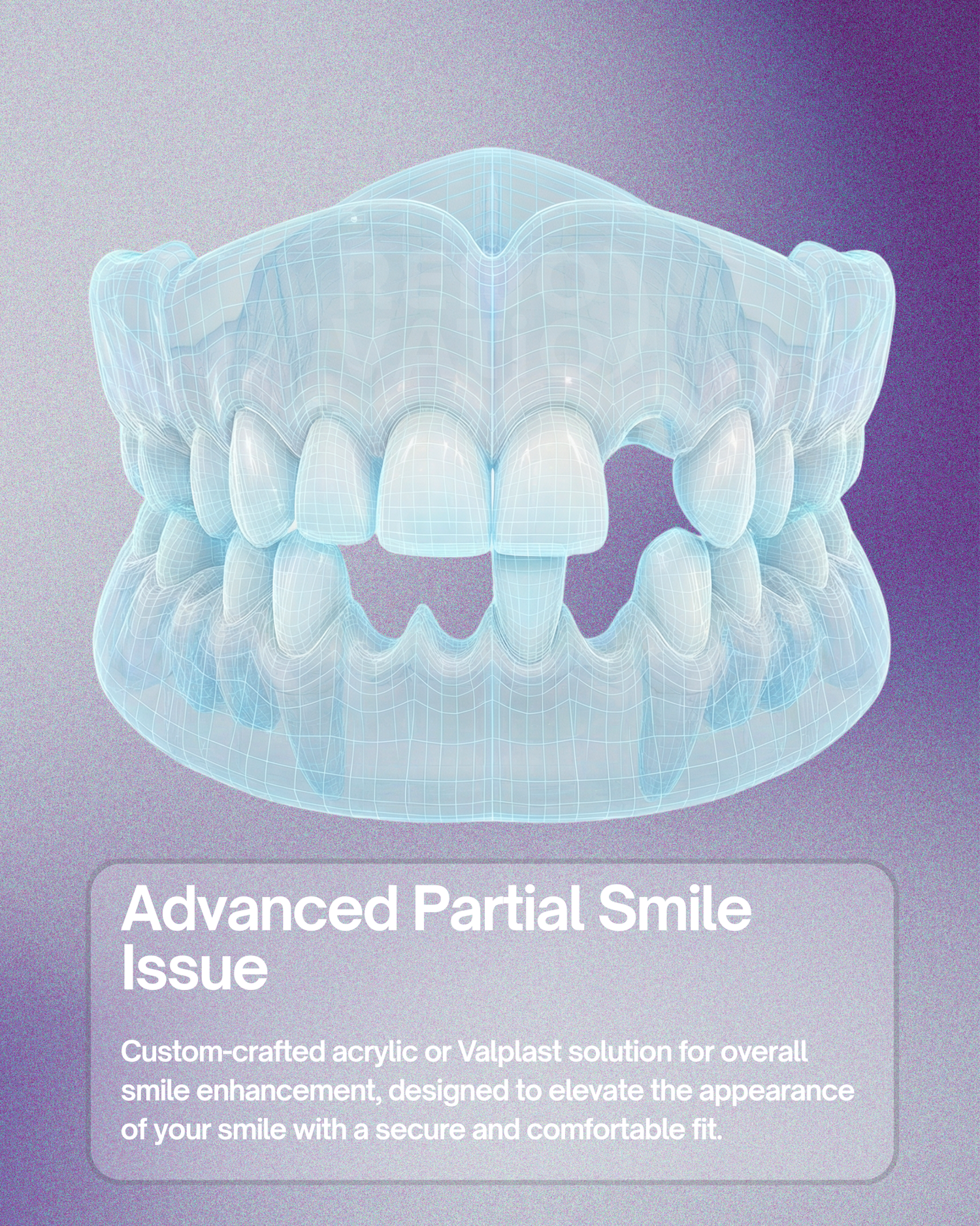 Partial Dentures (2+ Teeth)
