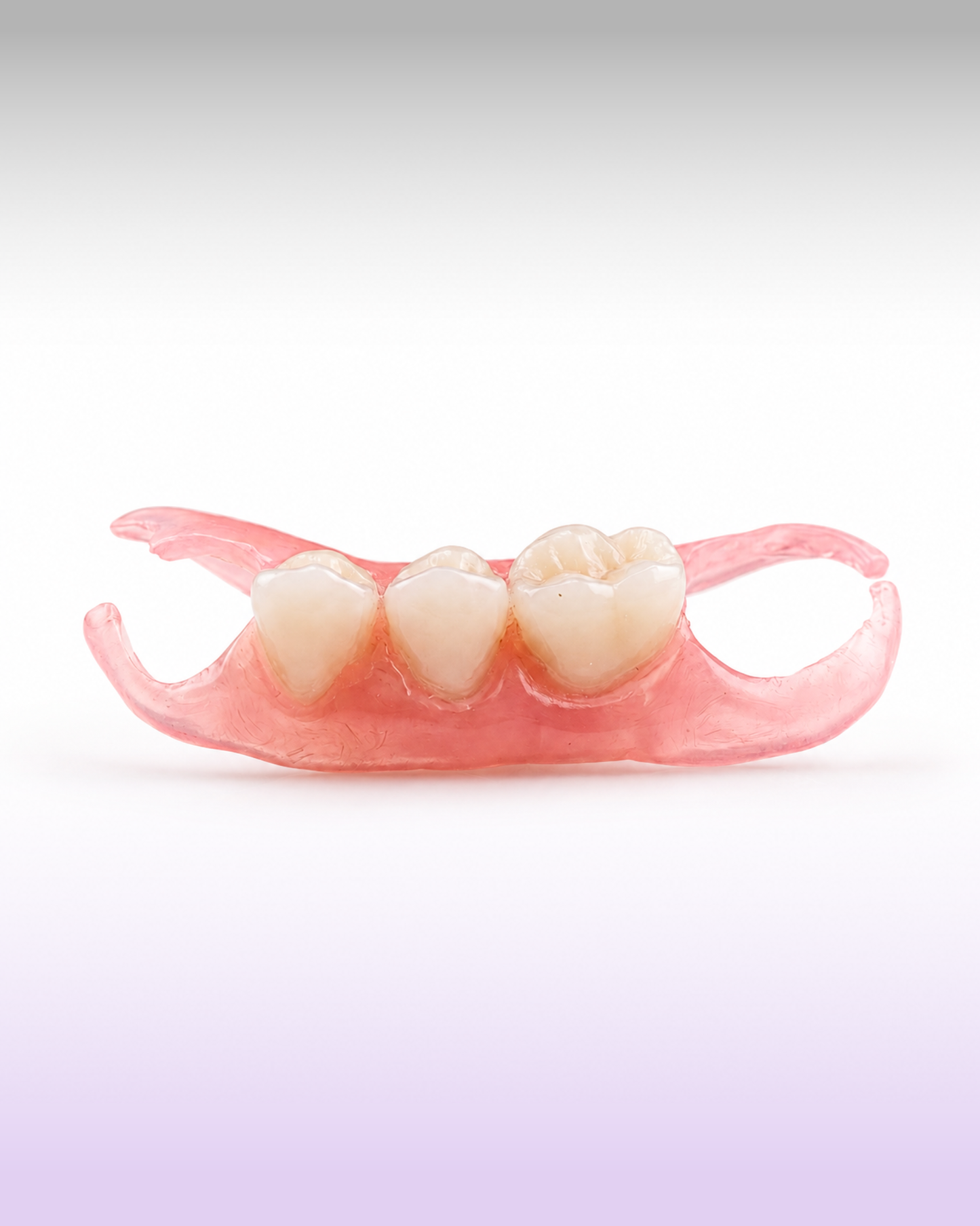 A dental implant bridge or partial denture appliance with three artificial teeth set in gum-colored thermoplastic resin, shown on a white to light purple gradient background.
