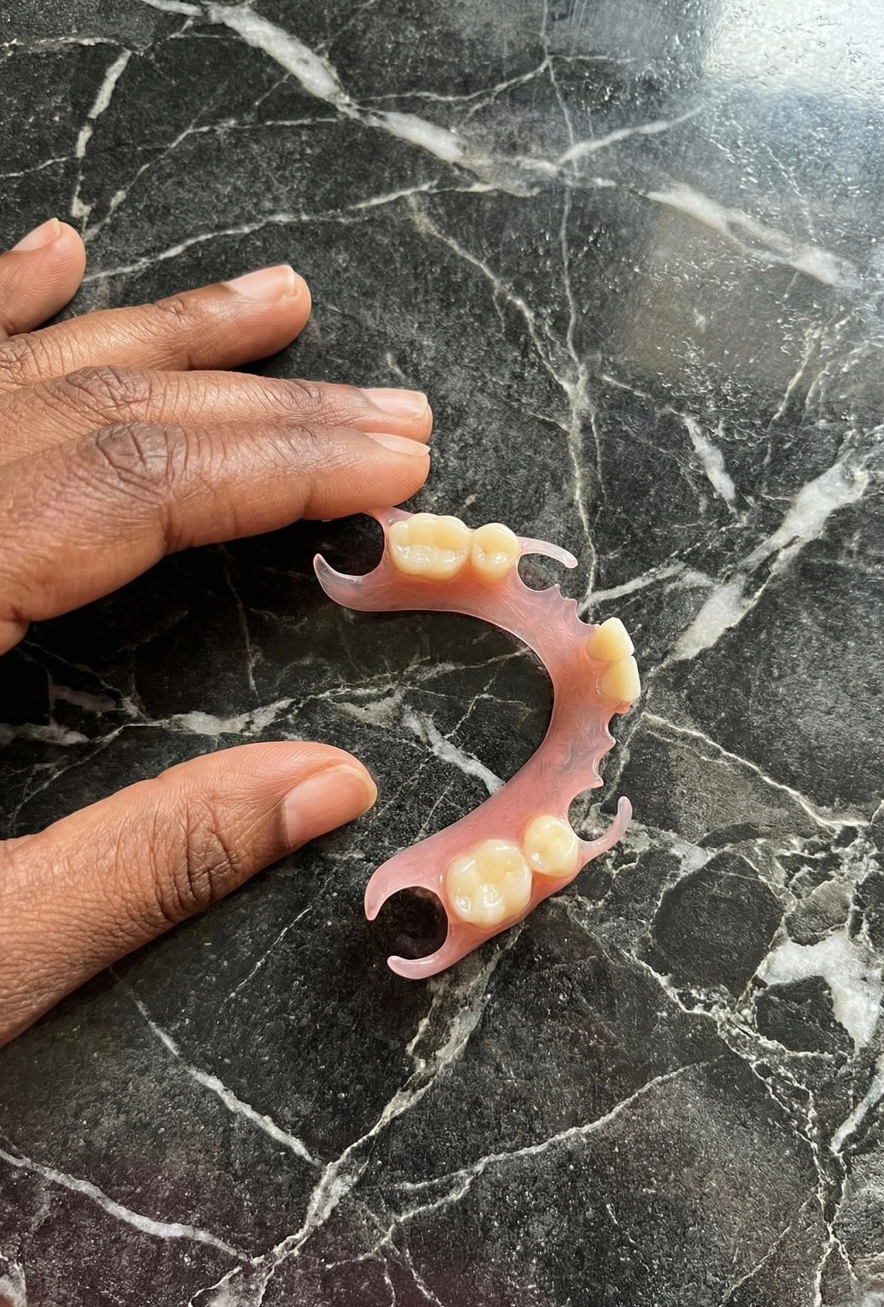 partial denture on a marble table