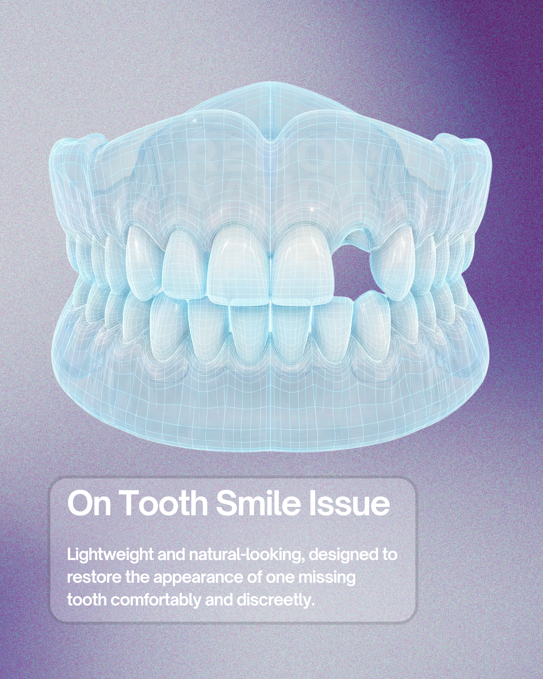 3D model of a dental scan on a gradient purple background
